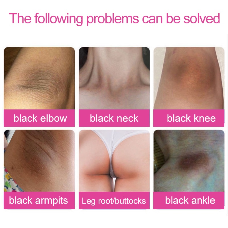 Pemutih Ketiak Dan Selangkangan Bpom Underarm Cream Pencerah selangkangan Pemutih ketiak Memutihkan Selangkangan/ Bagian Pribadi/ Melembabkan Kulit Pemutih ketiak Pemutih selangkangan Underarm cream efektif memutihkan leher/tangan/kaki/miss