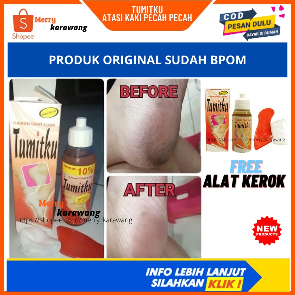 TUMITKU original Obat kaki pecah dan kering foot cream ampuh bpom original