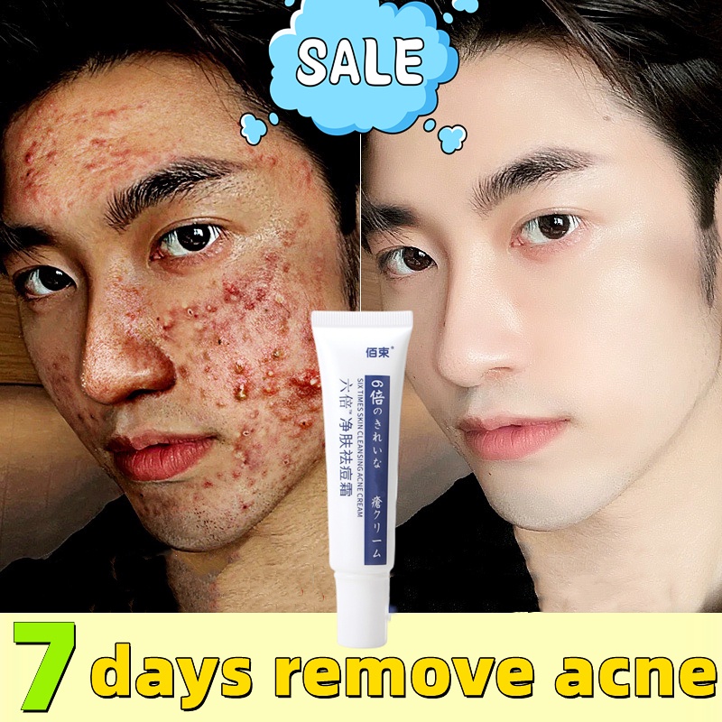 Jual acne pimple cream acne remover cream acnemed acne care gel cream