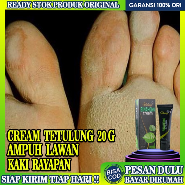 Jual Obat Kaki Rayapan Telapak Kaki Salep Kaki Rayapan Cream Tetulung