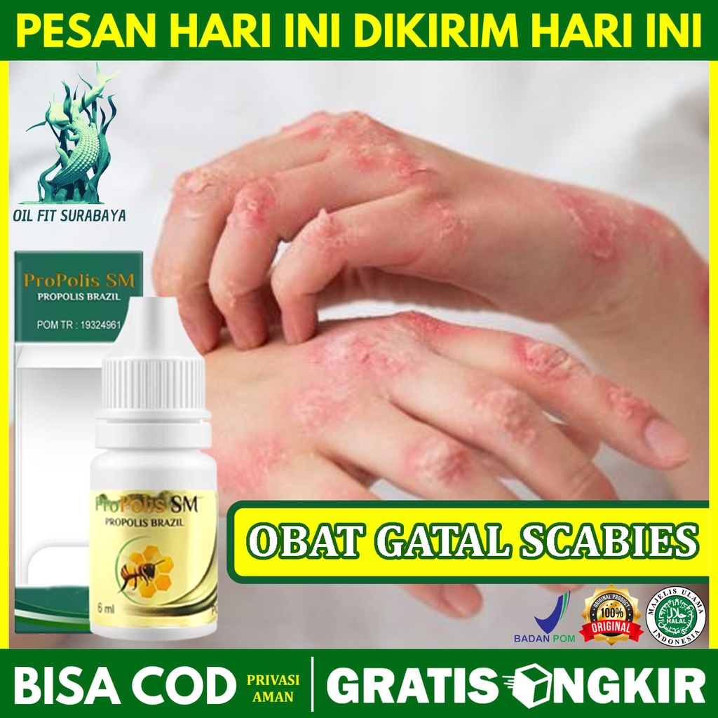 Propolis Anti Gatel Salep Kurap Panu Scabis Original