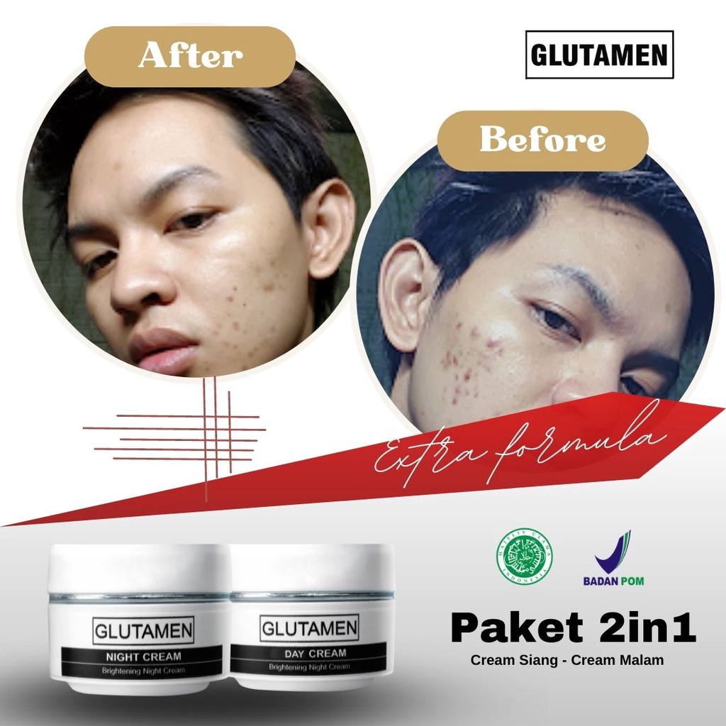 Glutamen Skincare BPOM Cream Siang Krim Brightening Malam Pemutih Wajah Penghilang Jerawat Pria