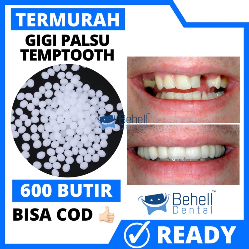 TER MURAH !! 600 BUTIR TEMPTOOTH GIGI PALSU SEMENTARA PENAMBAL GIGI PATAH RENGGANG / TEMTOOTH / BAHAN TAMBAL GIGI BOLONG BERLUBANG / TEMPORARY TOOTH INSTAN PRAKTIS / TEMPTOOTH GINGSUL PATAH LEM ORIGINAL ISI 600 / 500 / 400 / 300 / 200 / 100 BUTIR