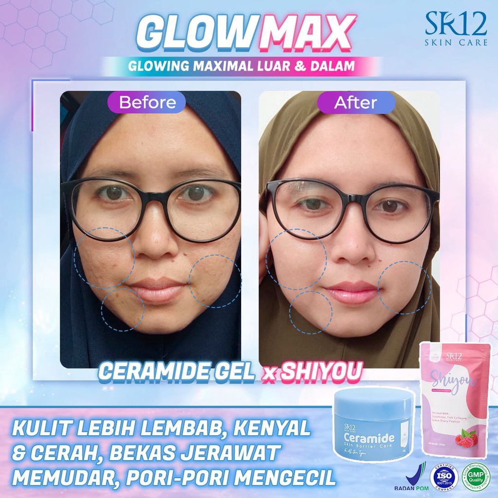 Shiyou Collagen SR12 Minuman Collagen Mencerahkan Kulit Pemutih Badan BPOM