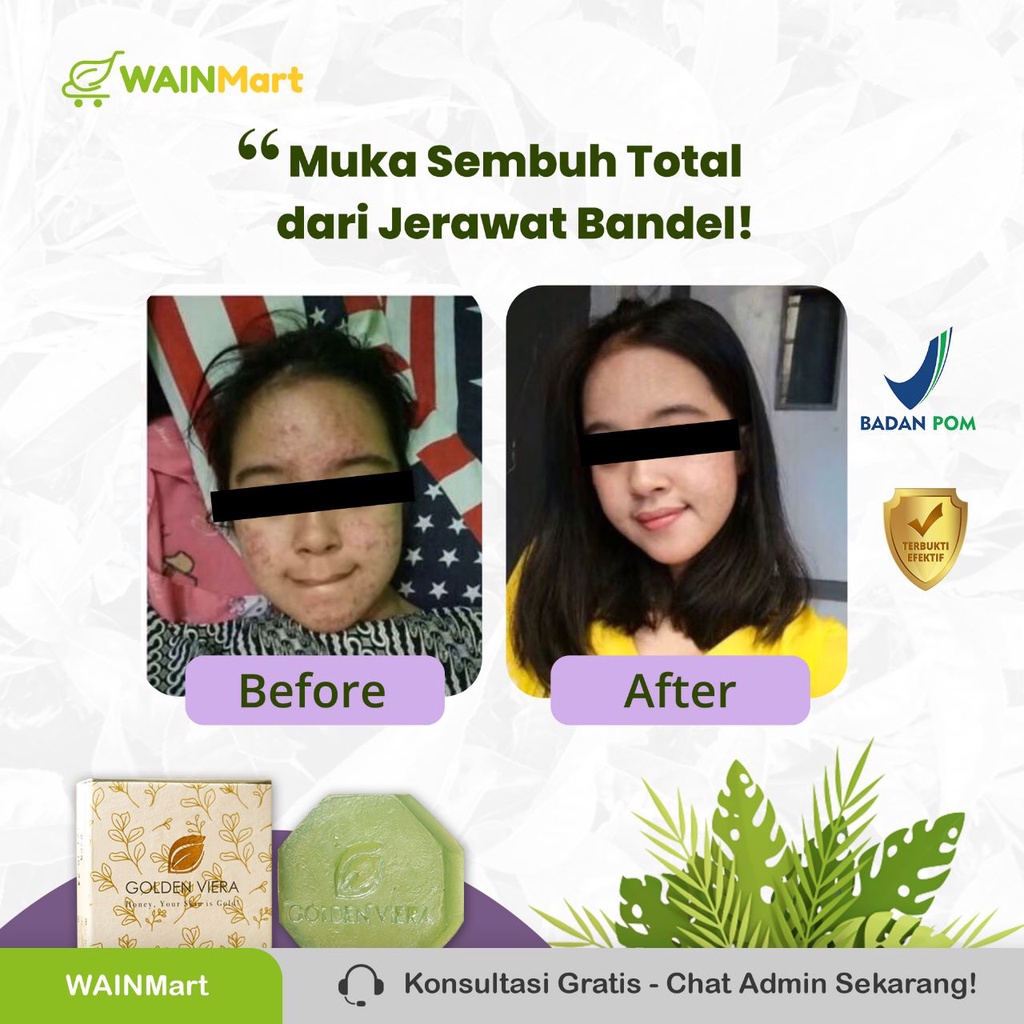 Golden Viera Sabun Herbal Kesehatan BPOM Cerahkan Kulit Natural Sembuhkan Luka Samarkan Bekas Luka dan Jerawat