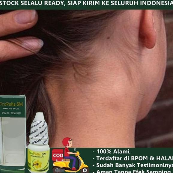 

Discount Obat Benjolan Di Leher Kiri, Kanan, Belakang, Depan, Belakang Telinga /OBAT TELINGA BERDENGUNG/OBAT TELINGA BERAIR/OBAT TELINGA TERSUMBAT/OBAT TELINGA BUDEG/OBAT TELINGA BERNANAH