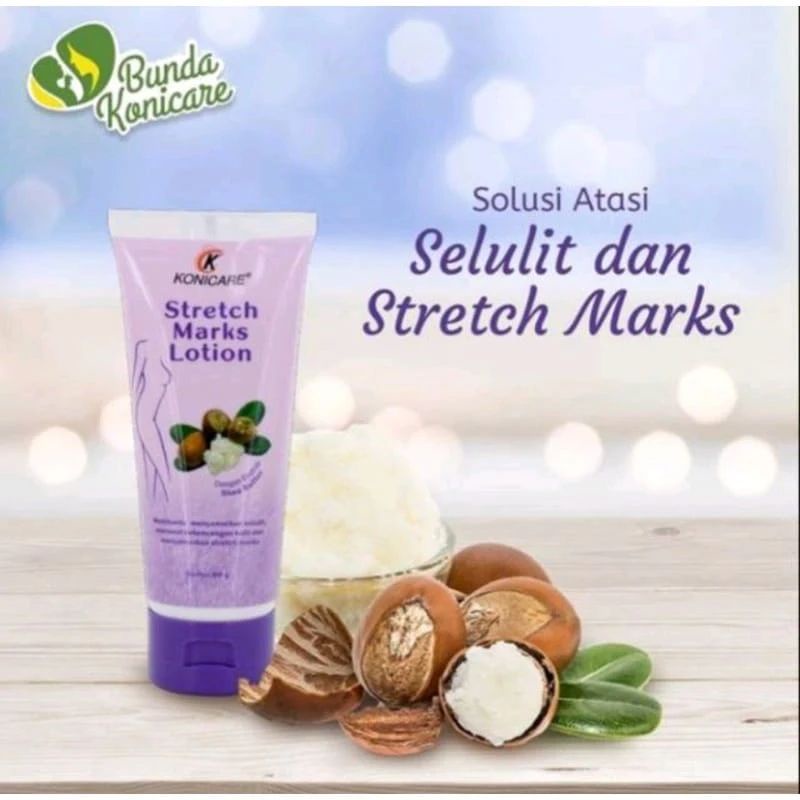 Konicare Stretch Marks Lotion