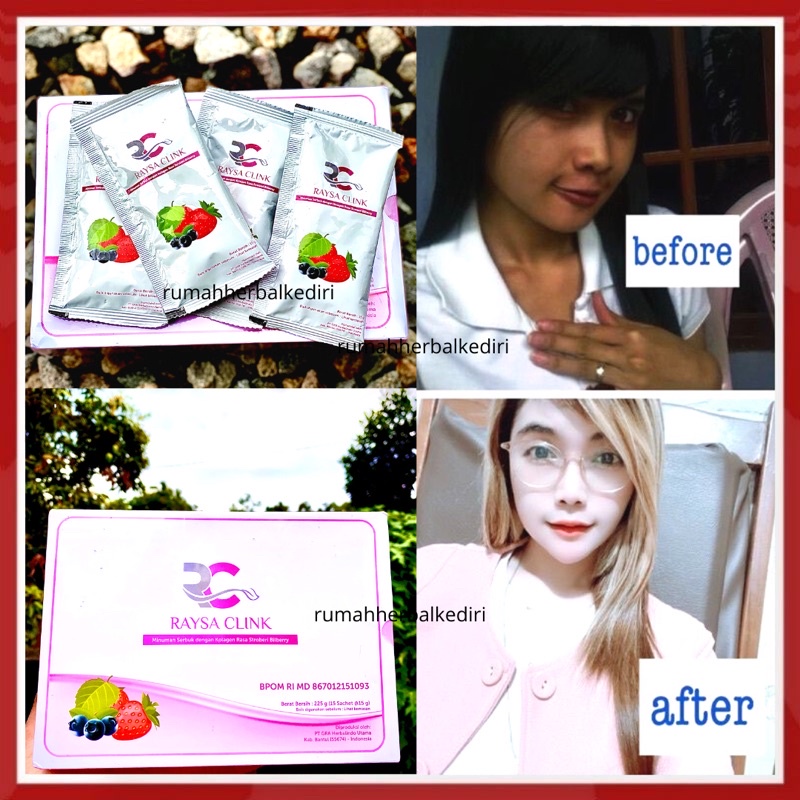 COLLAGEN BOOSTER BY raysa clink/ bisa untuk masker premium