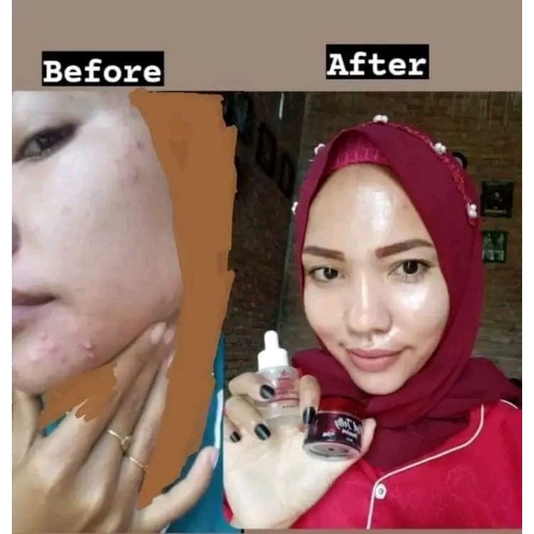 RK SERUM WAJAH PREMIUM RK RED JELLY KOSMETIK VIRAL AMPUH RKGLOW WAJAH GLOWING