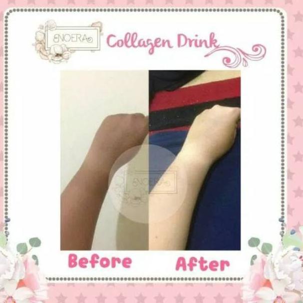 

⇿ NOERA Collagen Drink - Minuman Kolagen ➚