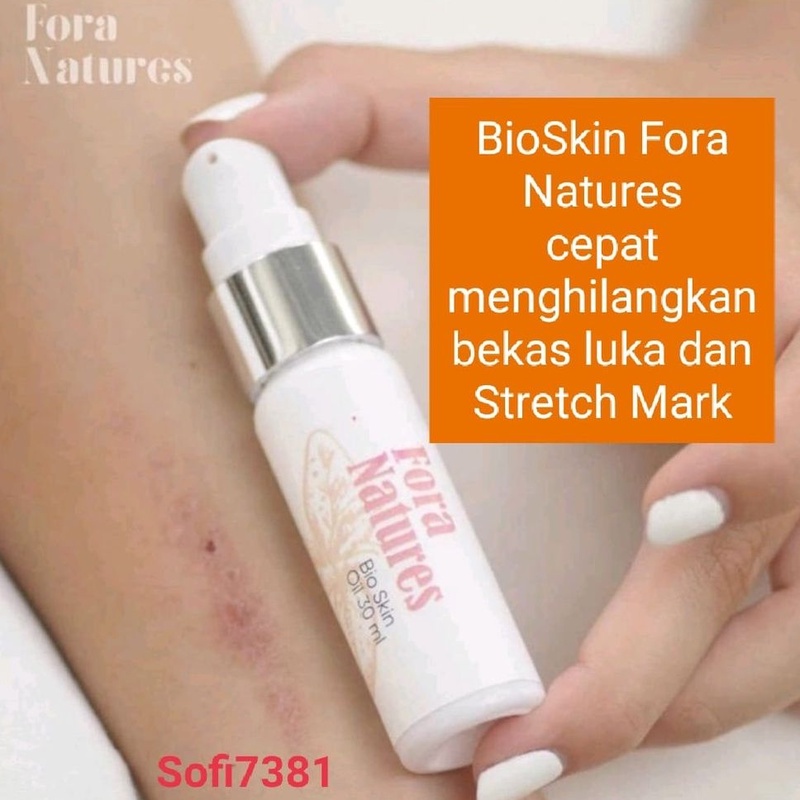 FORA BIOSKIN Natures 30 ml penghilang bekas luka, stretchmark