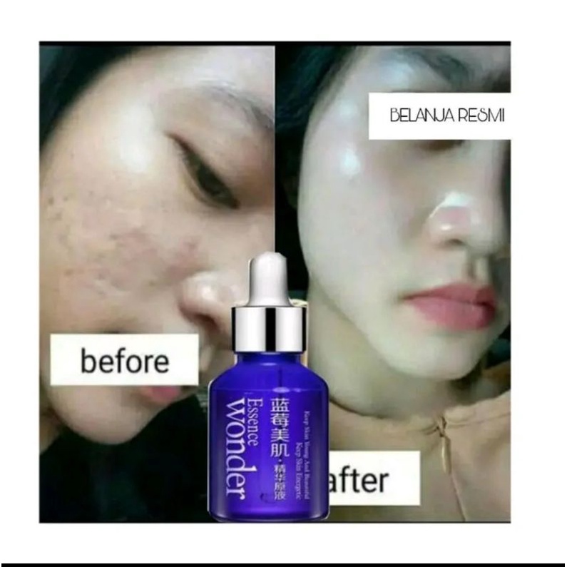 Best Seller Serum Pemutih Wajah Extra Cepat Serum Glowing Penghilang Flek Alami