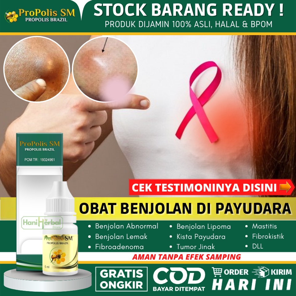 Obat Benjolan Di Payudara, Tumor Payudara, Kista Payudara, Abses Payudara, Bisul di Payudara, Fibroa