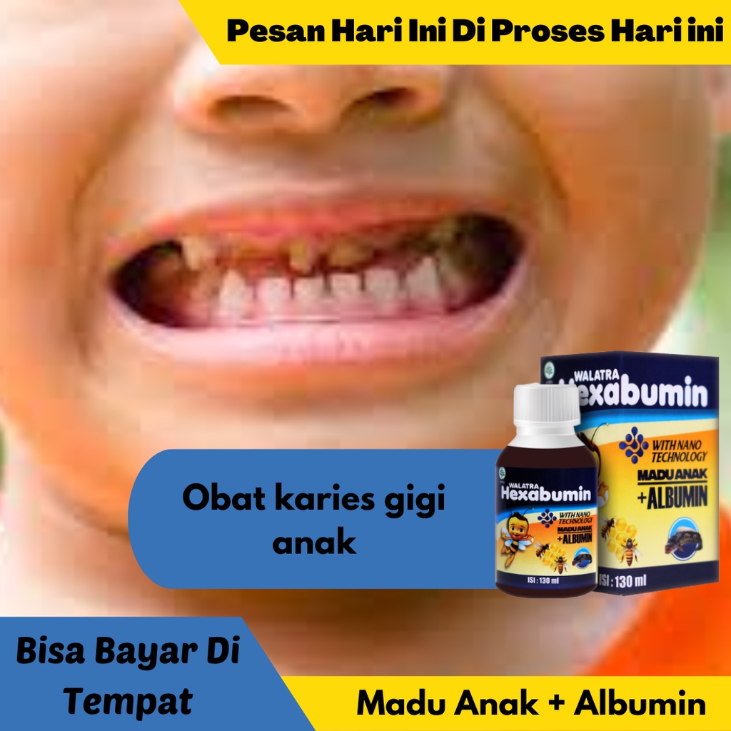 Obat karies gigi anak , Obat Penghilang Gigi Berlubang Anak , Gigi Ronges , Sakit Gigi Anak | HEXABU