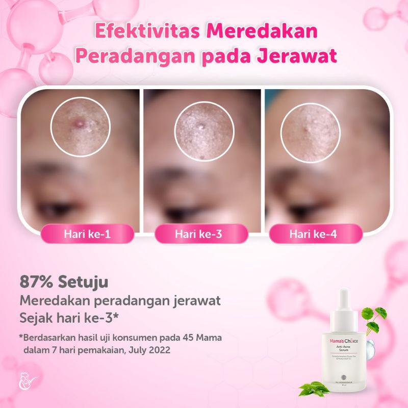 Mama's Choice Anti Acne Face Serum | Serum Wajah Berjerawat Aman untuk Ibu Hamil dan Ibu Menyusui