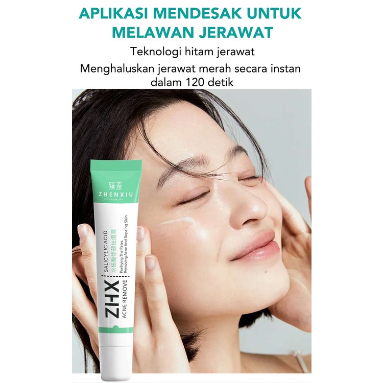 [Beli 1 Gratis 1] Herbal Oil Control Acne Cream-Whitening Mengatur Keseimbangan Minyak Air Kulit Stok tersedia, tiba dalam 3 hari