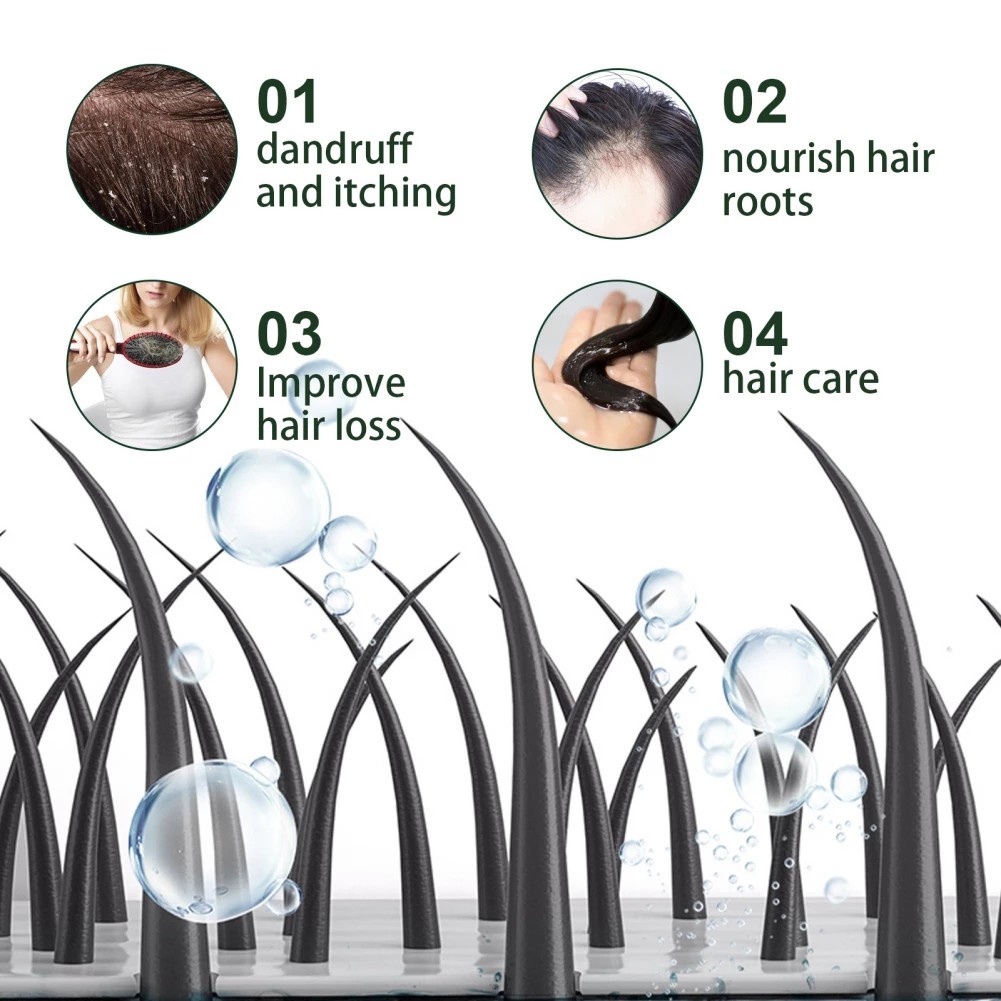 Penumbuh Rambut Penumbuh Rambut Botak Serum Nutrisi Rambut Jahe 30ml Penumbuh Rambut Cepat Anti Rontok Ginger Hair Growth Essence Hair Cairan Essence
