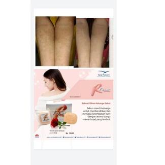 

⁂ rosan sabun badan dan wajah ッ