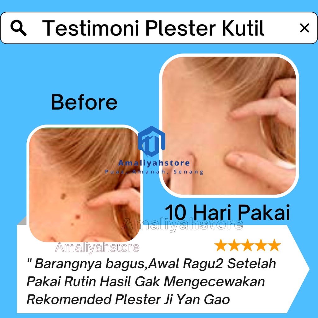 Plester Mata Ikan Obat Kapalan Kutil Dan Mata Ikan Di Kaki Tangan Leher Plester Ji Yan Gao Hansaplast Mata Ikan Untuk Penghilang Tahi Lalat Ampuh Skin Tag Remover Cream Permanen