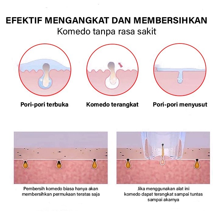 barokah gamis AMCARE - BLACKHEAD REMOVER