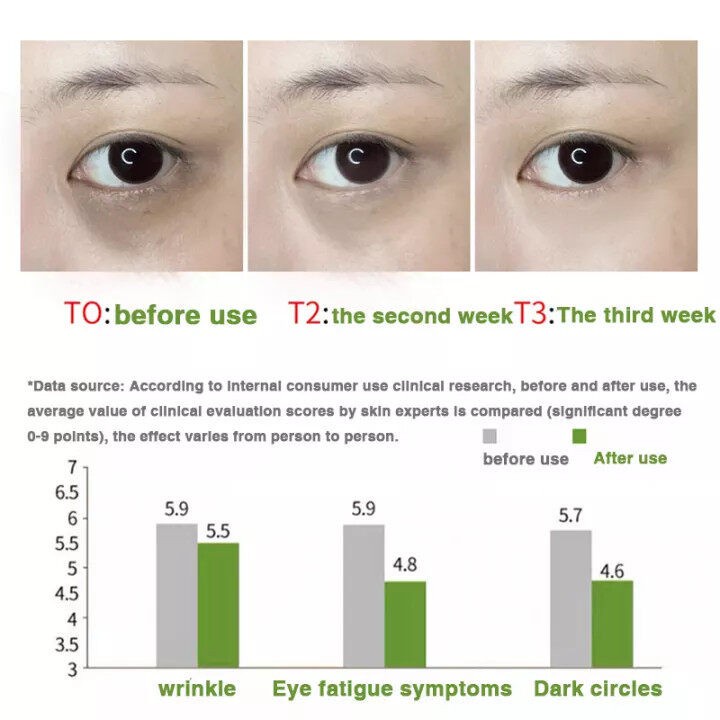 Eye Cream Anti Aging Glowing Eye Cream 30g  Dark circle eye cream Skin Care Nourishing Panda Eye Treatment  Meringankan kantung mata dan butiran lemak