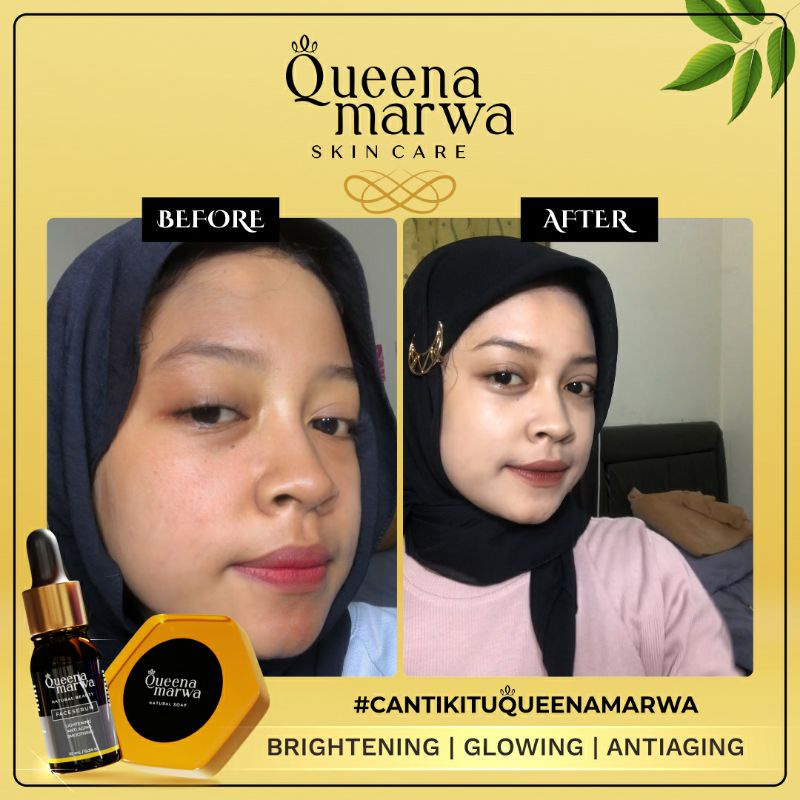 Queena Marwa Natural Soap Original Sabun Wajah Aman BPOM 80 gr