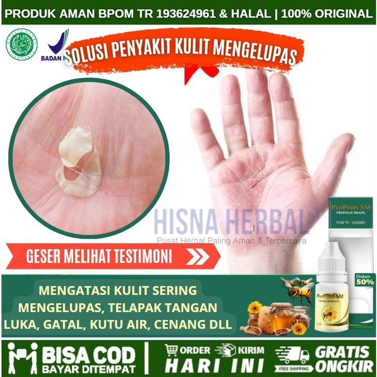 Obat Kulit Mengelupas dan Gatal, Obat Alami Kulit Mengelupas Di Selangkangan, Obat Kulit Bersisik da