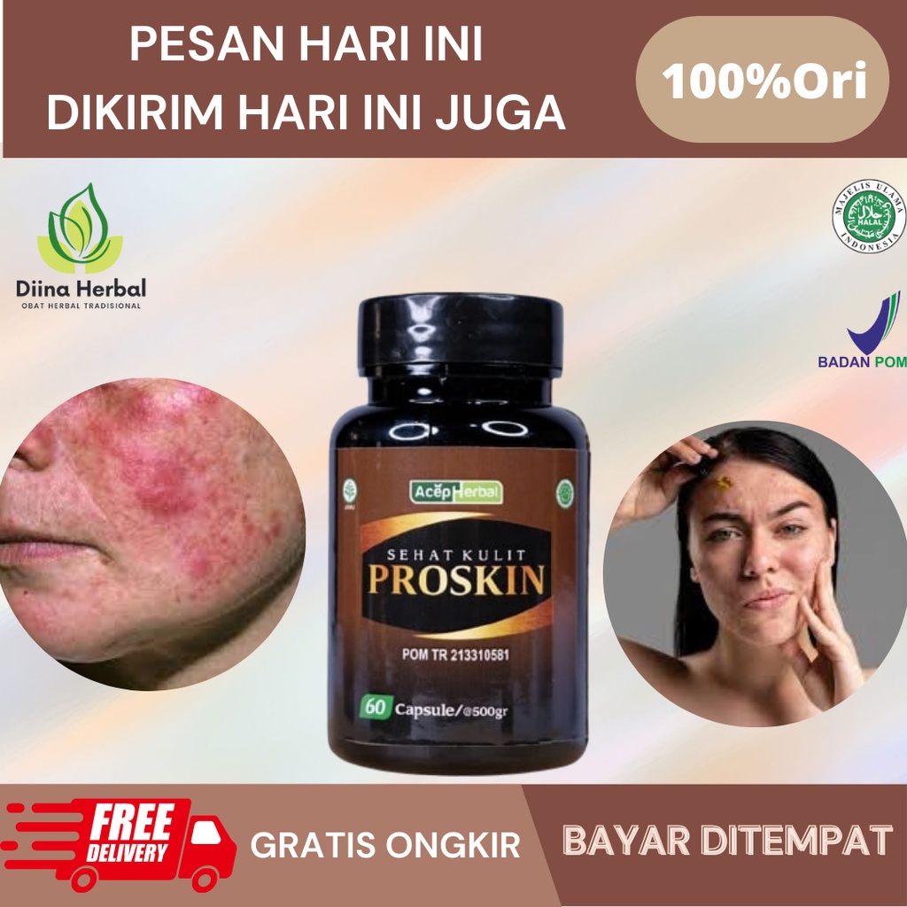 Obat Rosacea, Obat Kemerahan Pada Kulit Wajah, Obat Bintik Merah Diwajah, Obat Acne Jerawat, Obat He