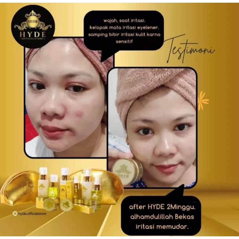 [FREE GIFT] HYDE SKINCARE PAKET GLOWING ISI 5 FORTE | SERUM LEMON / SERUM SAKURA