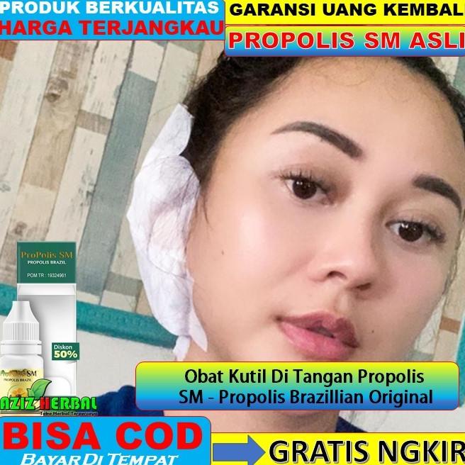 

BAYAR DITEMPAT Obat Gendang Telinga Pecah /Bernanah Propolis SM - Propolis Brazillian /OBAT TELINGA BERDENGUNG/OBAT TELINGA BERAIR/OBAT TELINGA TERSUMBAT/OBAT TELINGA BUDEG/OBAT TELINGA BERNANAH