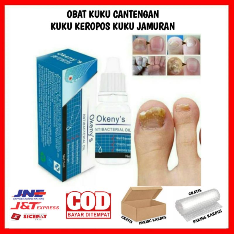 OBAT KUKU CANTENGAN KUKU KEROPOS KUKU JAMURAN