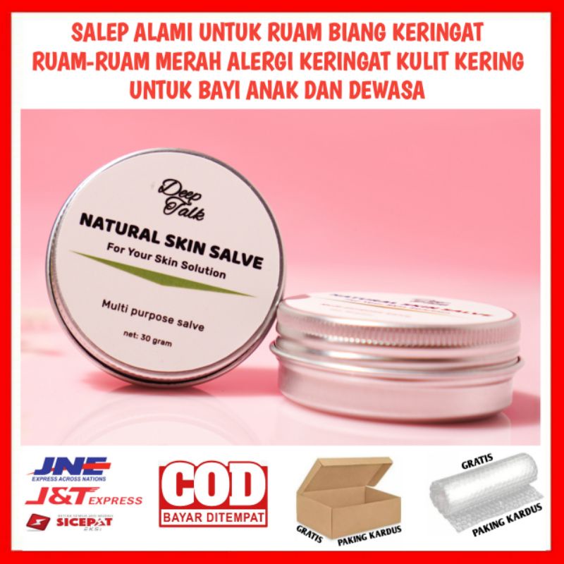 SALEP ALAMI UNTUK RUAM BIANG KERINGAT RUAM-RUAM MERAH ALERGI KERINGAT KULIT KERING UNTUK BAYI ANAK D