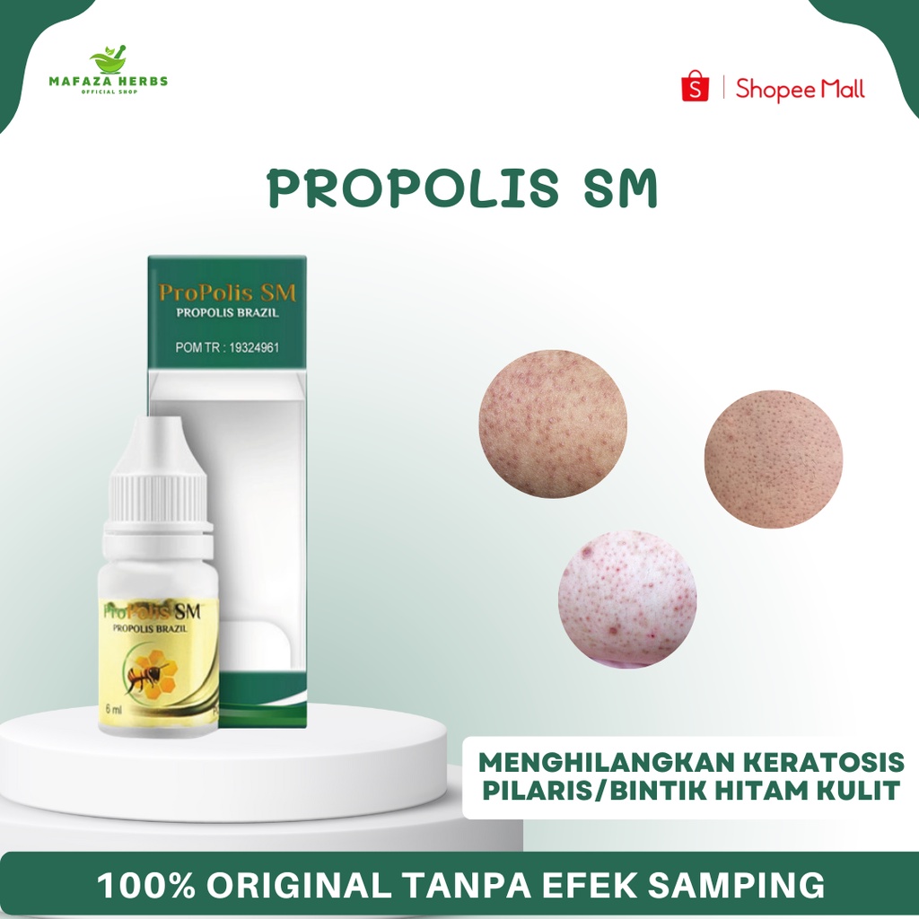 Jual Obat Keratosis Pilaris Obat Bintik Hitam Di Kulit Obat Kulit