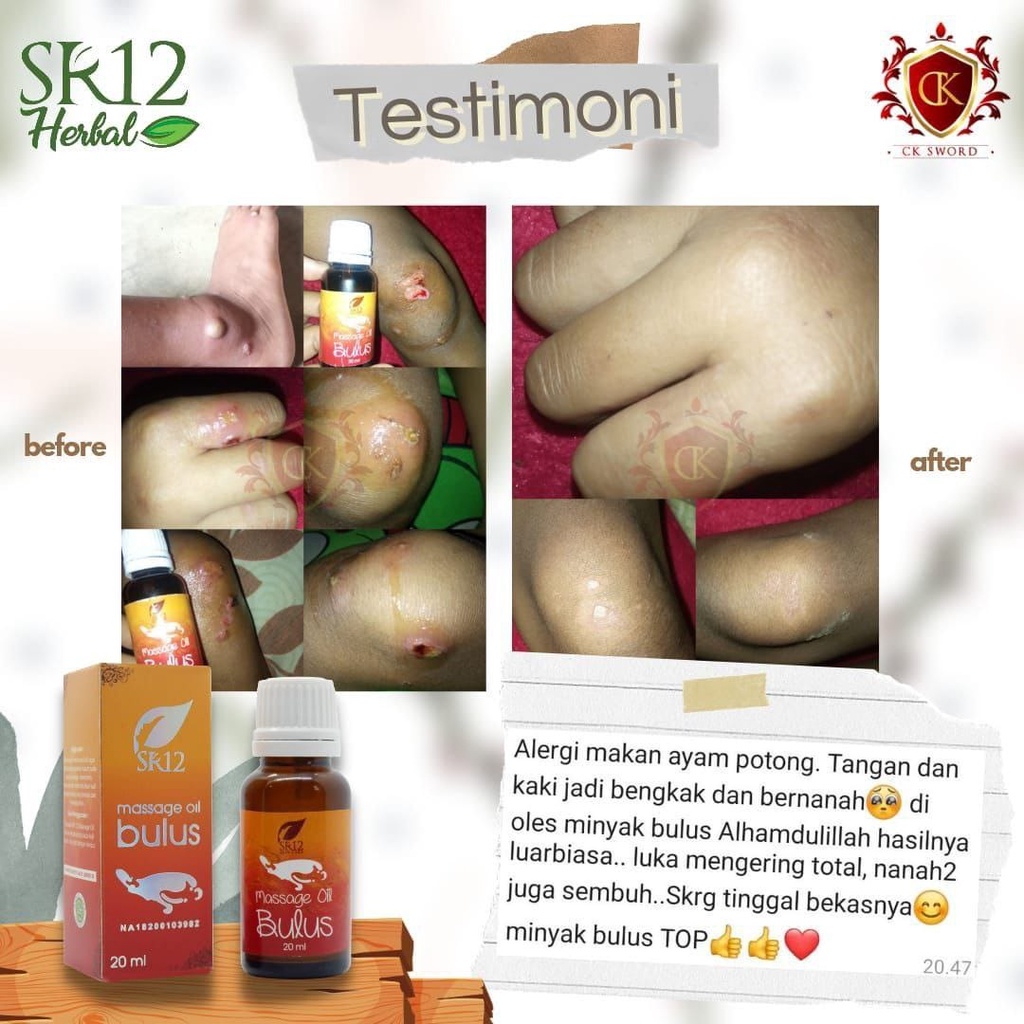 Minyak Bulus SR12 Original Massage Oil Bulus Murni Obat Gatal Kulit BPOM SR12 Pengencang Payudara Treatment Kulit Wajah Dan Tubuh