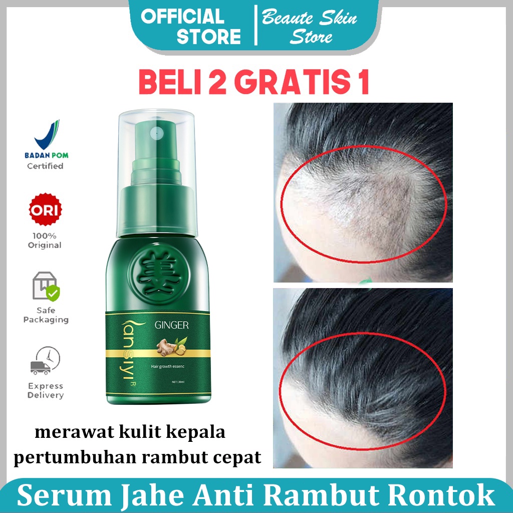 Perawatan Rambut Rontok Serum Rambut Rontok 30ml Semprotan Pertumbuhan Rambut Memelihara akar rambut dan memperbaiki folikel rambut