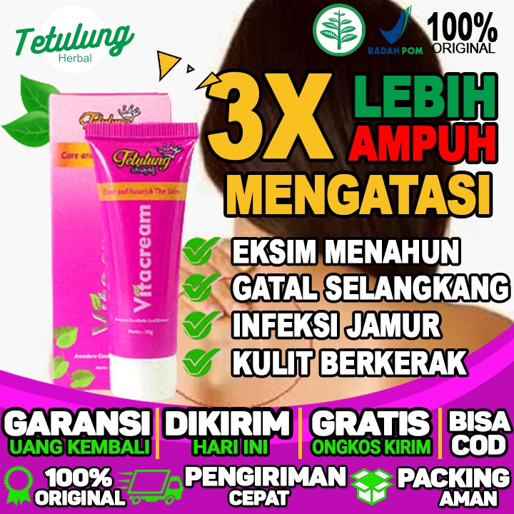 salep untuk gatal berair salep untuk gatal bruntusan salep untuk gatal bintik merah