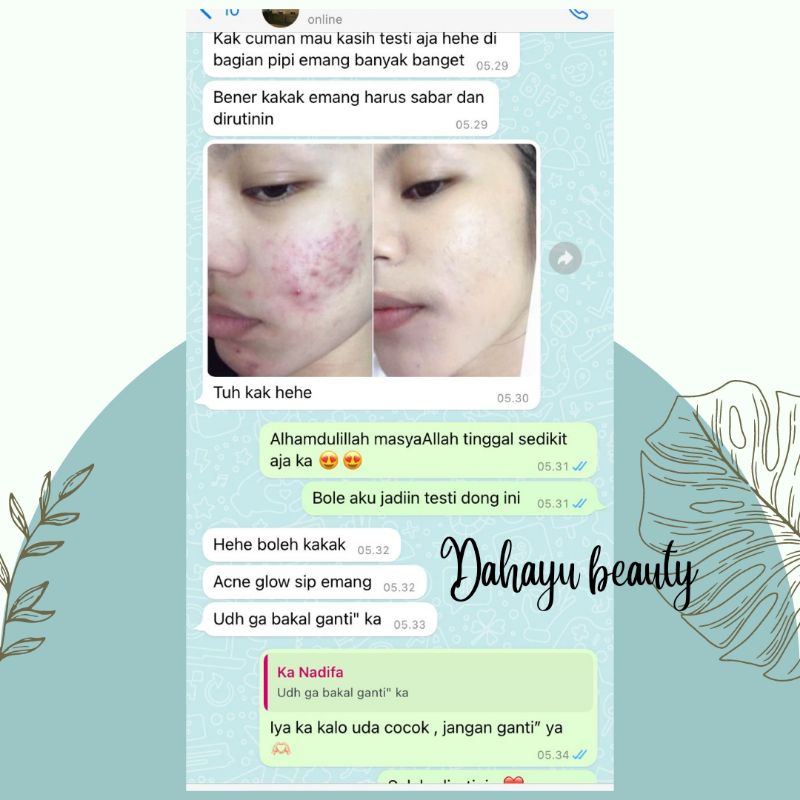 PAKET ACNE GLOWING SUPER