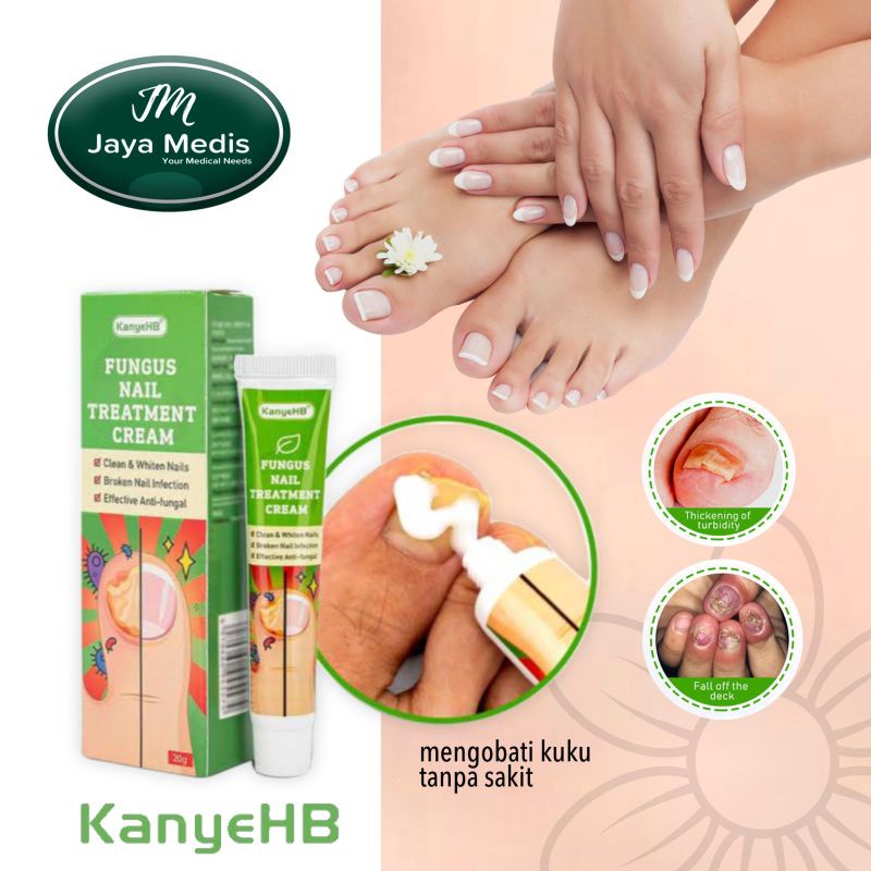 CREAM PERAWATAN KUKU RUSAK - FUNGUS NAIL TREATMENT KENYE HB PERAWATAN KUKU