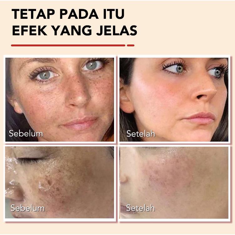 Arbutin Brightening Essence Natural Whitening Menghilangkan Bintik Hitam Meningkatkan Elastisitas Kulit Mengurangi Jerawat