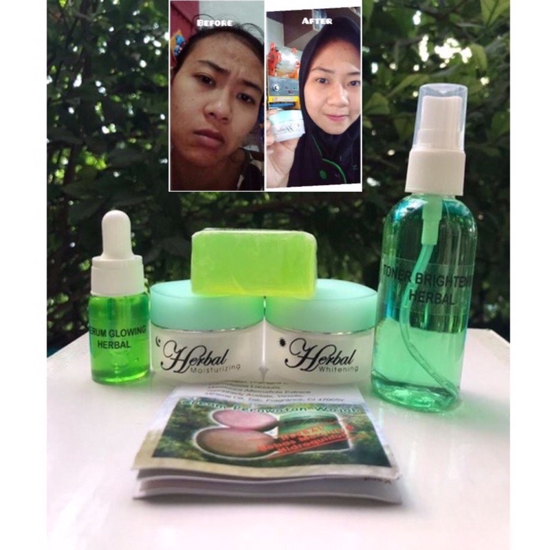 CREAM HERBAL TUTUP HIJAU FLEK HITAM ORIGINAL PAKET LENGKAP GLOWING