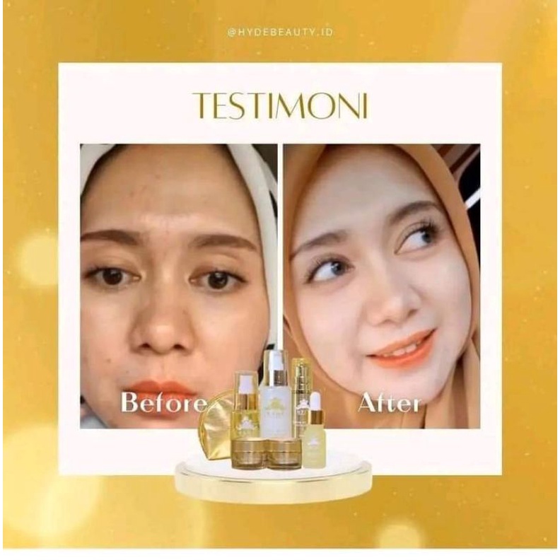 [FREE GIFT] HYDE SKINCARE PAKET GLOWING ISI 5 FORTE | SERUM LEMON / SERUM SAKURA