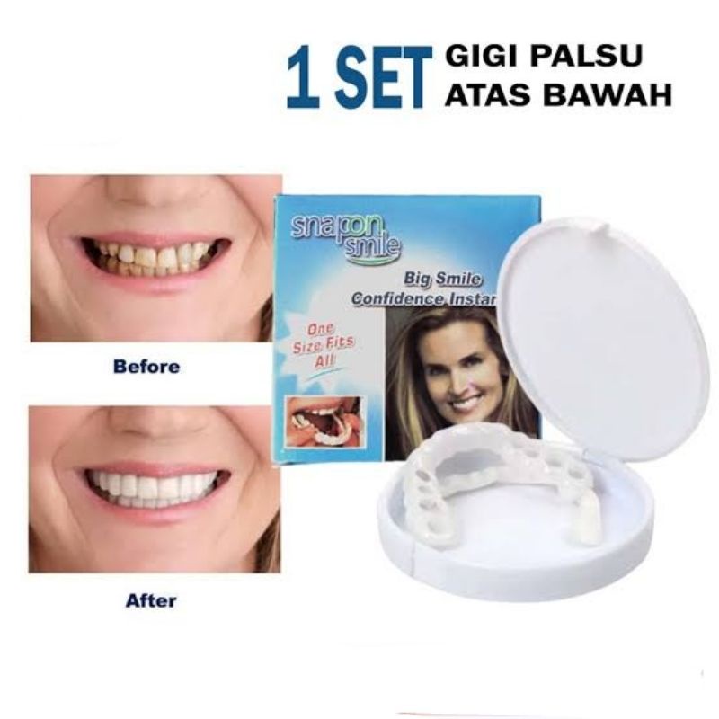 Snap On Smile Gigi Palsu | Set Atas Bawah - Gigi Palsu Silikon