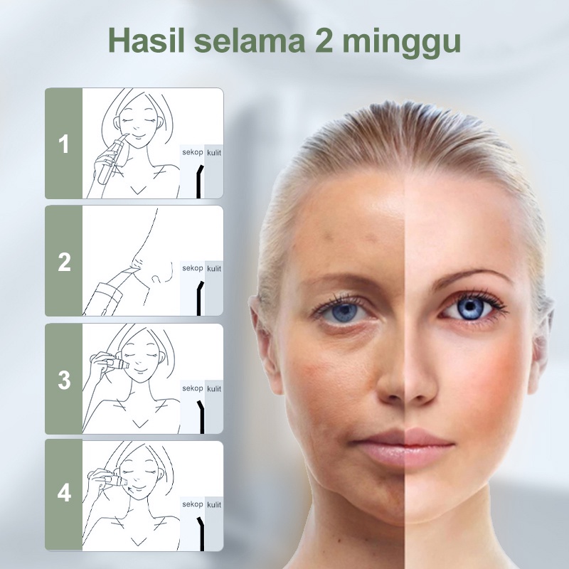 AmazeFan alat pembersih komedo elektrik wajah alat penyedot hidung blackhead remover pencabut sedot komedo pengangkat penghilang jerawat pembersih komedo blackhead