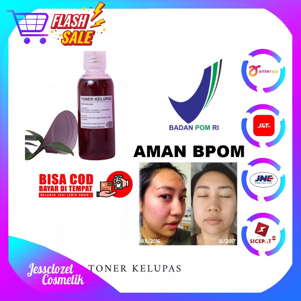 Fleksol Toner Pengelupas Wajah Whitening Pencerah Wajah Penghilang Flek Hitam Bekas Jerawat 60 Ml