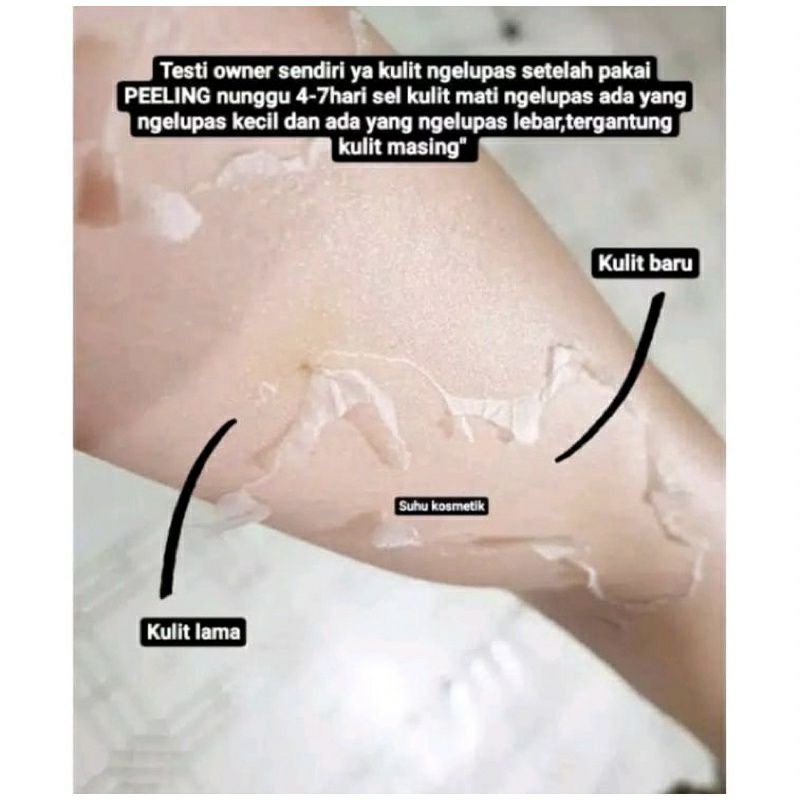 PEELING BADAN PENGELUPASAN T20% AMPUH ORIGINAL