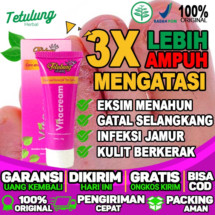 Salep Untuk Kulit Kering Dan Gatal Salep Untuk Gatal Eksim Dan Salep Untuk Gatal Eksim Basah