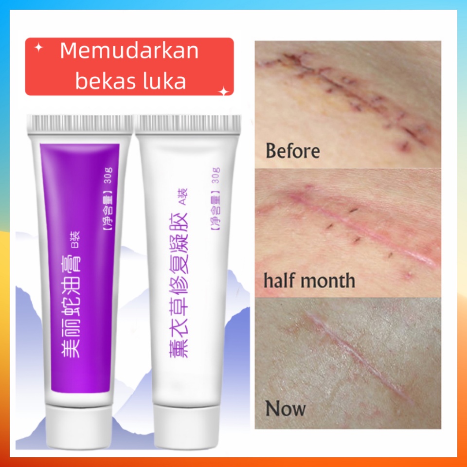 Jual Fujiemeibao Penghilang Bekas Luka Memperbaiki Luka Bakar Dan Menghilangkan Stretch Mark