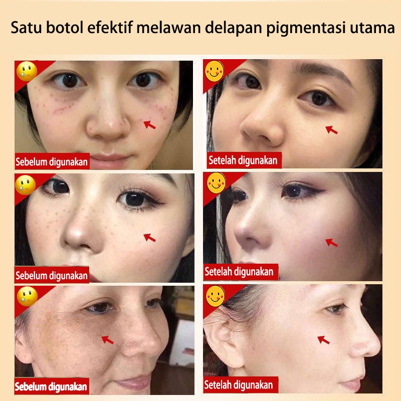 【COD】krim pemutih dan menghilangkan flek / krim pemutih wajah / memudarkan flek hitam menghilangkan jerawat / cepat menghilangkan bintik hitam menghilangkan flek hitam / menghilagkan bintik hitam / emmudarkan bintik hitam