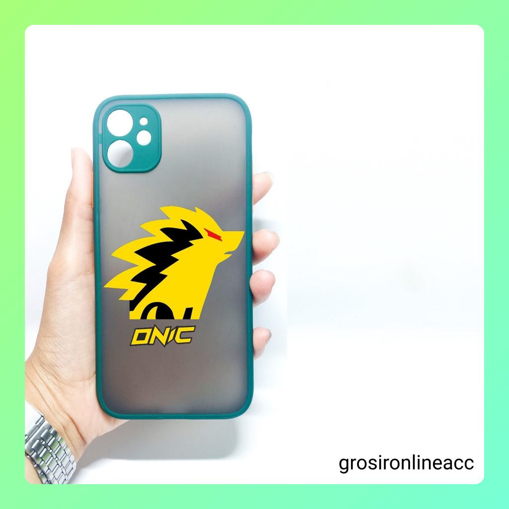 Casing Soft Kamera AA19 for Oppo A15 A15s A16 A16e A16k A17 A1k A11k A12 A31 A33 A3s A35 A36 A37 A39 A47 A5 A5s A52 A53 A57 A59 F1s A53 A53s A54 A55 A55s A7 A71 A72 A74 A76 A77 A83 A9 A92 A95 A96 F1 F3 F3+ F5 F7 F11 Pro Reno 3 4 4F 5 5F 6 7 7z 8