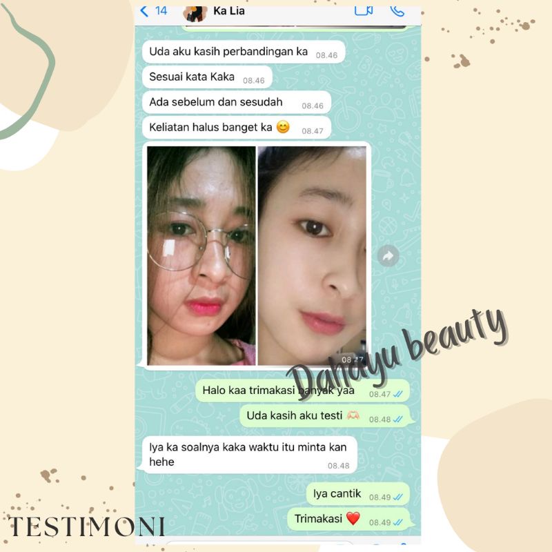 THERASKIN PAKET FLEK MELASMA